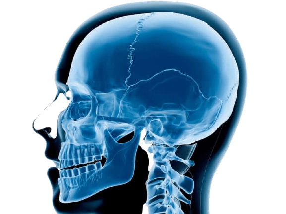 Craniofacial