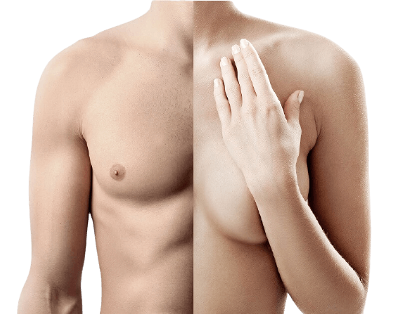 Gender Reassignment surgery